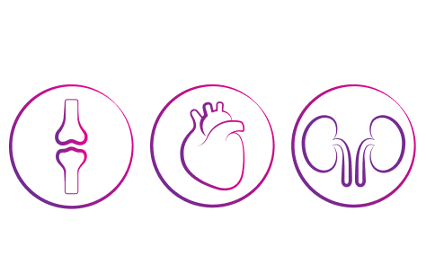 Uncontrolled gout can damage bones and vital organs icon